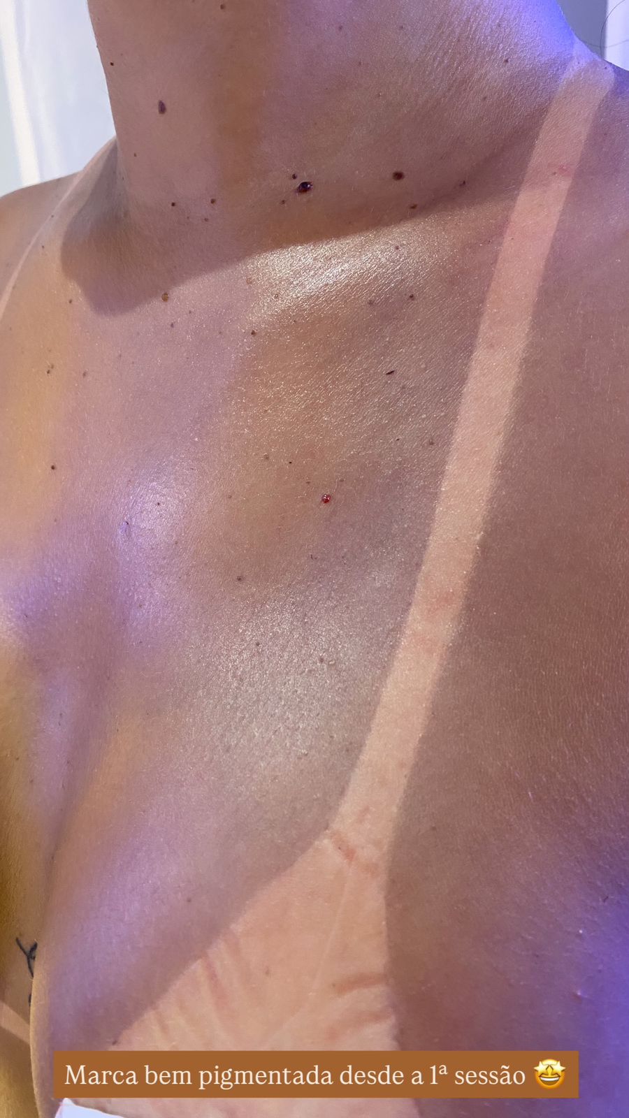 Cliente Seu Bronze - Pele iluminada e hidratada